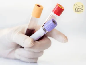 انخفاض مستوى السكر في الدم