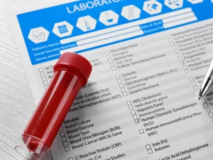 انخفاض تركيز الكالسيوم في دم القطط