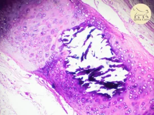 التهاب القصبات الهوائية المزمن عند القطط