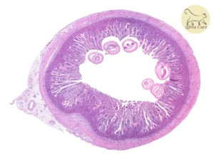 النمو الزائد للبكتيريا في الأمعاء الدقيقة