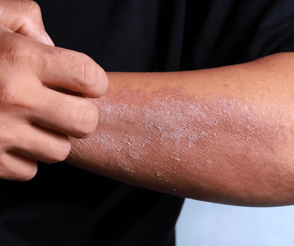 امراض القطط معدية للانسان