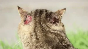 علاج القوباء الحلقية